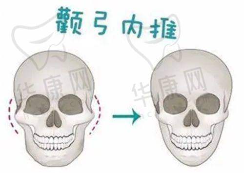 大连美天医疗美容医院张井忠软骨鼻综合的安心性保护