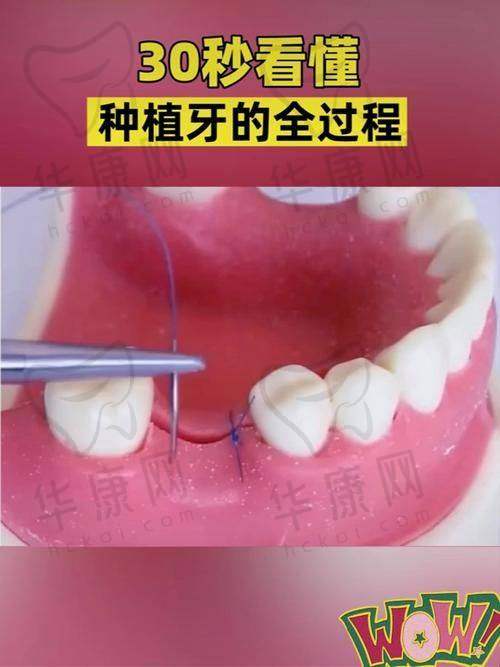 牡丹江美植口腔做全口种植真不错，牙齿矫正、种牙等问题统统“拿捏”！