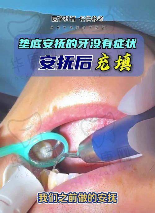 苏州金铂利口腔儿童进口树脂补牙2588元起，品质之选守护孩子口腔健康