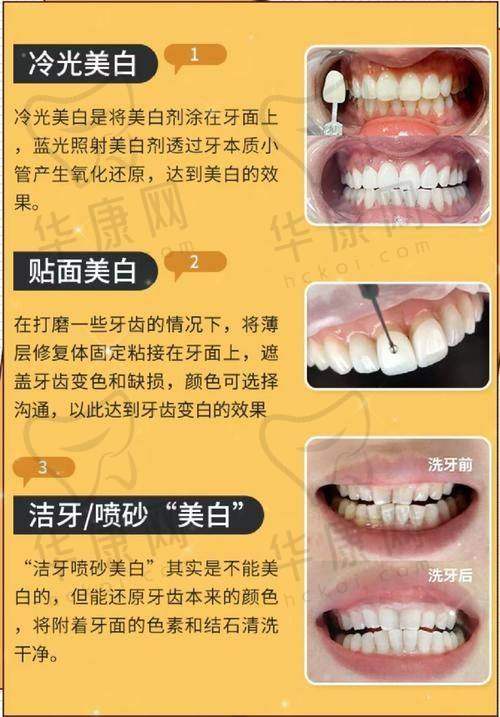 泰安牙博士口腔冷光美白680元起，专业技术开启牙齿焕白新体验！