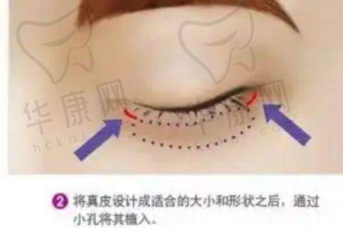 广州广大医院做正颌手术，预约方式有哪些？