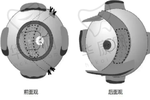 广州余文林唇裂修复费用是多少？