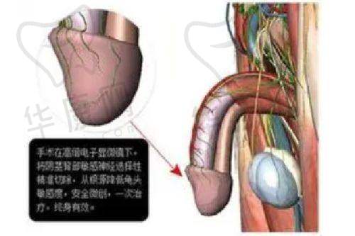 谢宏彬拉皮手术的口碑如何？