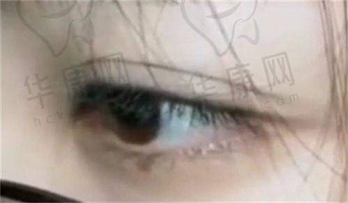 深圳阳光医院是正规且靠谱的医院，凭荣誉、团队及高满意度口碑立足深圳整形市场