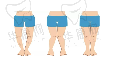 北京八大处郭鑫医生开眼角技术怎么样？原理是什么？