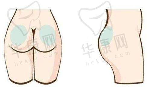 术后修复与成效