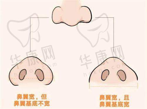 刘远程医生预约方式