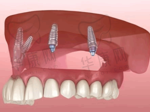淮安诺贝尔口腔医院的优势体现
