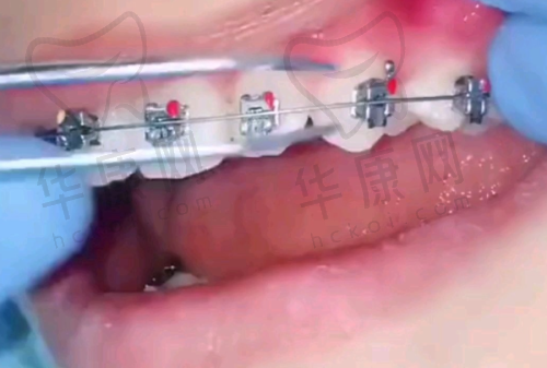 重庆种博士口腔门诊部患者评价