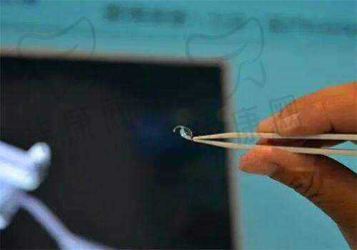 术后修复情况
