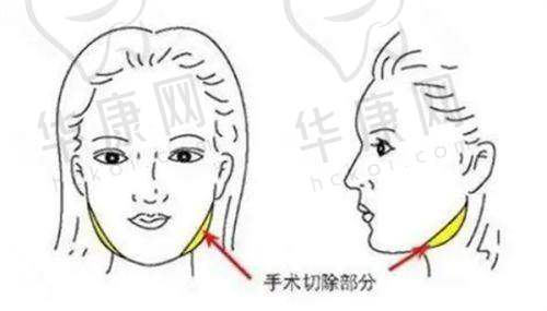 与其他医生对比的优势