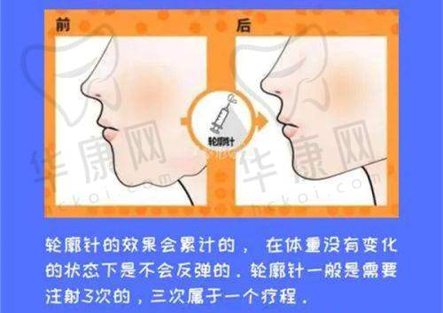 沈阳整形医院排名前十哪家比较好？含项目价格与案例助你选合适医院