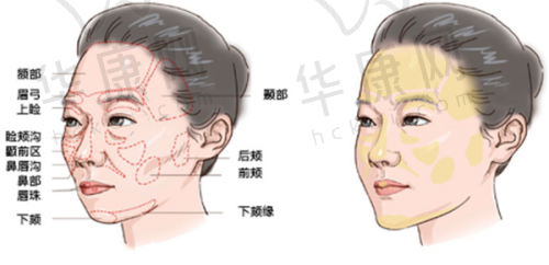 广州广大医院做正颌手术怎样预约？实力雄厚技术优，三种方式可约何锦泉医生