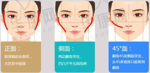 成都杨迪医生眼周筋膜提升值得尝试吗？