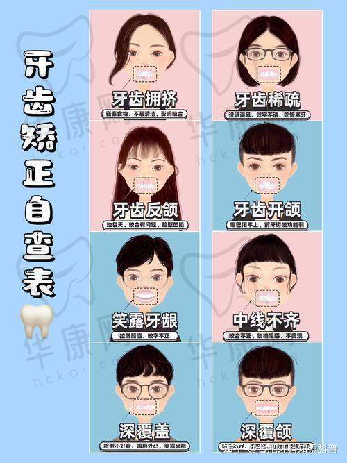 成都医大口腔医院隐适美隐形矫正的成功实例