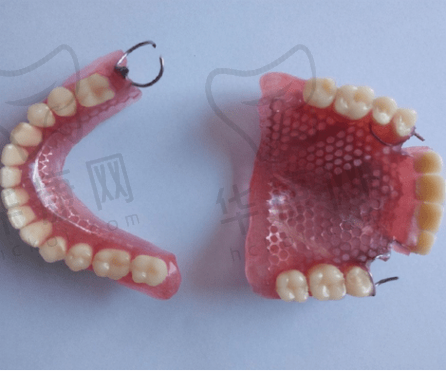 成都医大口腔医院全口活动假牙的服务特色