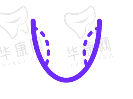 一般人适应舌侧矫正发音影响要多久?