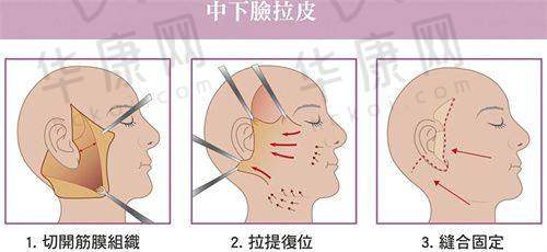 北京漾格医疗美容医院正规吗？