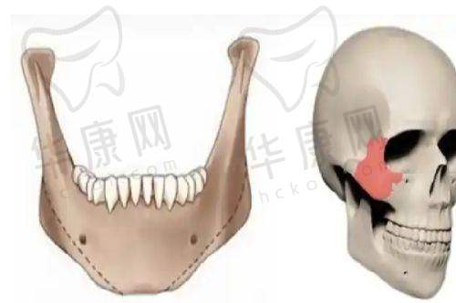 合肥华美整形外科医院朱德刚医生的口碑评价