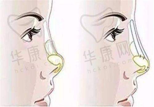 东莞壹加壹整形美容医院口碑真的好吗？