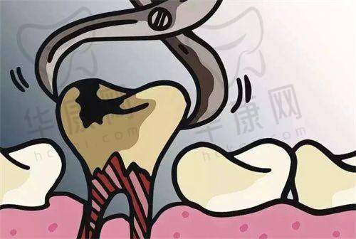 宜春袁州春城口腔拔牙价格便宜且医生技术还好，智齿、蛀牙问题轻松搞定！