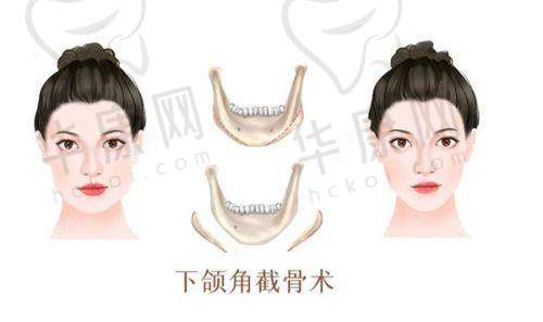 东莞华美詹慧医生的修复优势是什么？