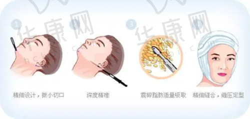 东莞壹加壹整形美容医院是正规的，简介靠谱口碑好且收费透明，值得求美者信赖！