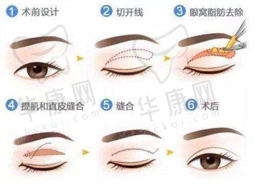 东莞西妃刘波医生的技术亮点在哪？