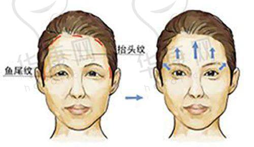 中山美南华美容医院常海眼部整形的口碑与评价