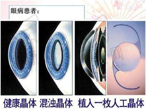 医生单宝泉在吸脂塑形项目的特色优势
