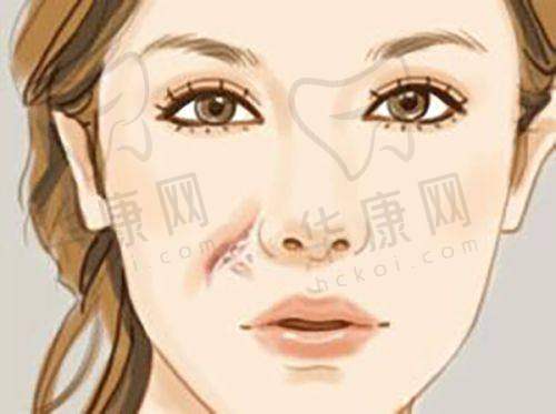 哈尔滨韩美医疗美容刘毅红斑敏疤痘成功实例展示