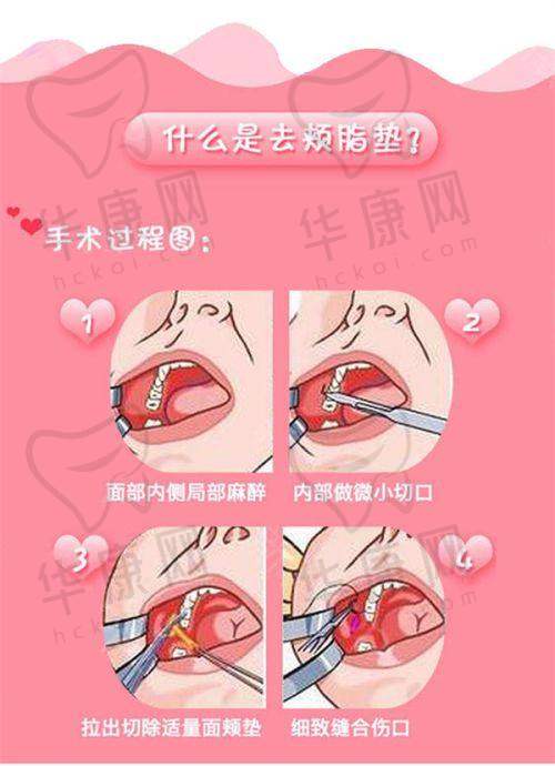 影响成都达芬奇去眼袋价格的因素