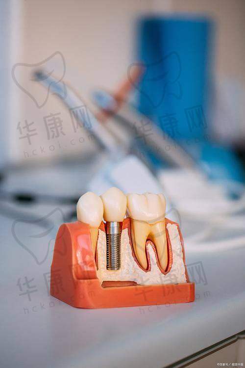 上海维乐口腔的其他口腔项目价格