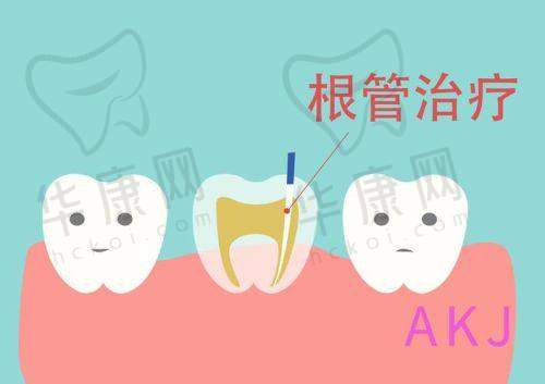 重庆美奥口腔前牙即刻根管治疗的实例展示