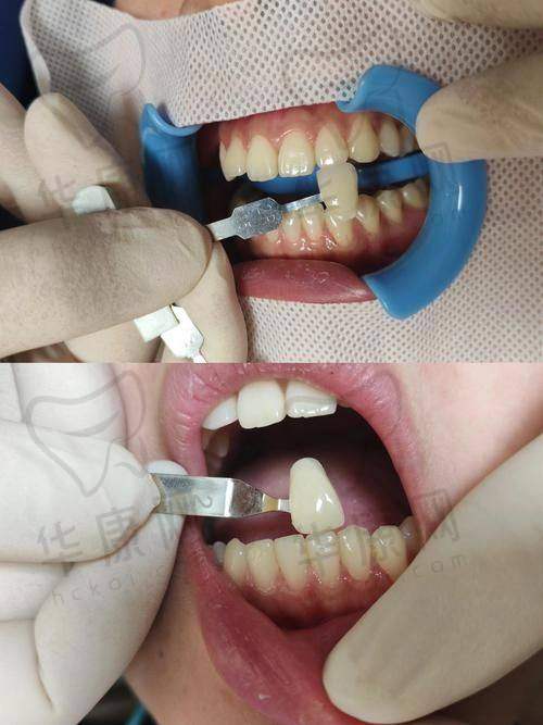 广州德仁口腔冷光美白之医院特色优势