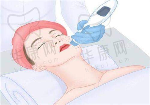 哪种拉皮手术更适合你？