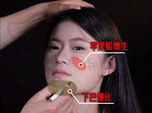 烟台壹美天成医疗美容医院陈山伟医生预约方式