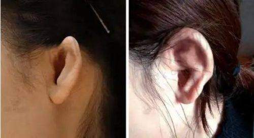 诊疗成效与感受