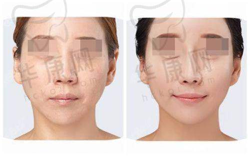 上海江城皮肤病医院正规吗？