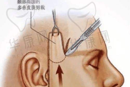 上海江城皮肤病医院预约挂号流程：