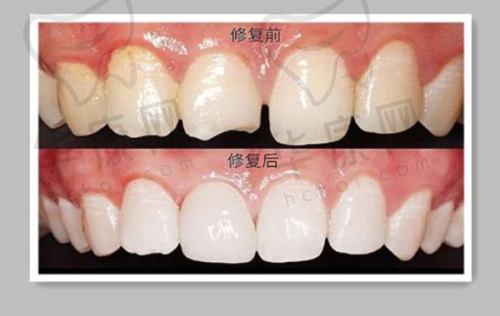 孝感咿呀口腔医院设备完善吗?治疗是否更便捷?