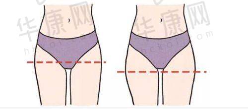 上海薇琳医疗美容医院患者评价