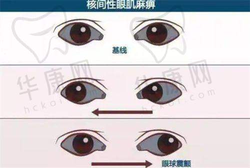 手术过程