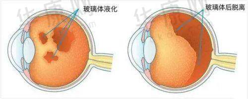 杭州黑马眼科的服务与口碑