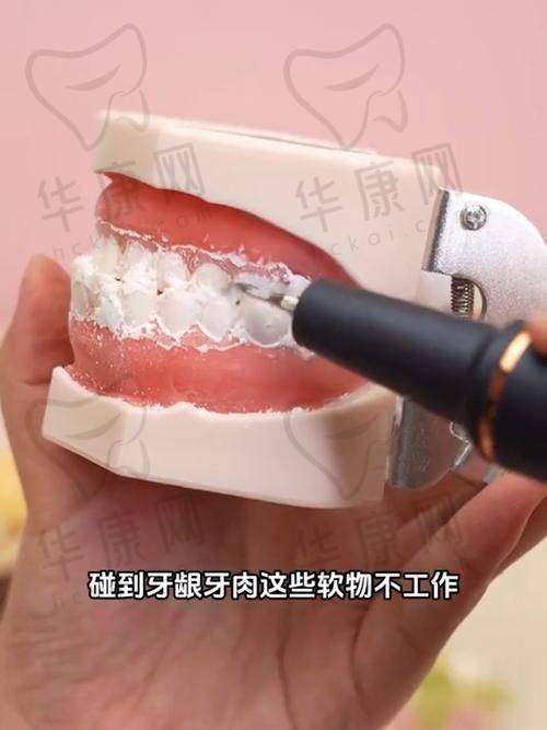 沈阳医博上诚口腔超声波洁牙仅100元起，正规实惠开启口腔清洁新体验！