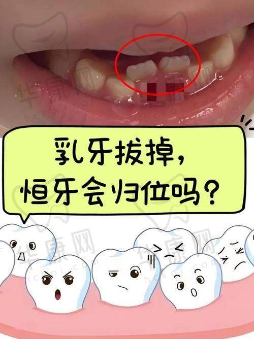 重庆南岸名博士口腔乳牙拔除仅49元起，实惠之选守护儿童口腔健康