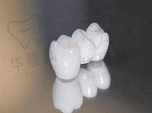 鞍山德立联合口腔爱尔创全瓷冠患者口碑