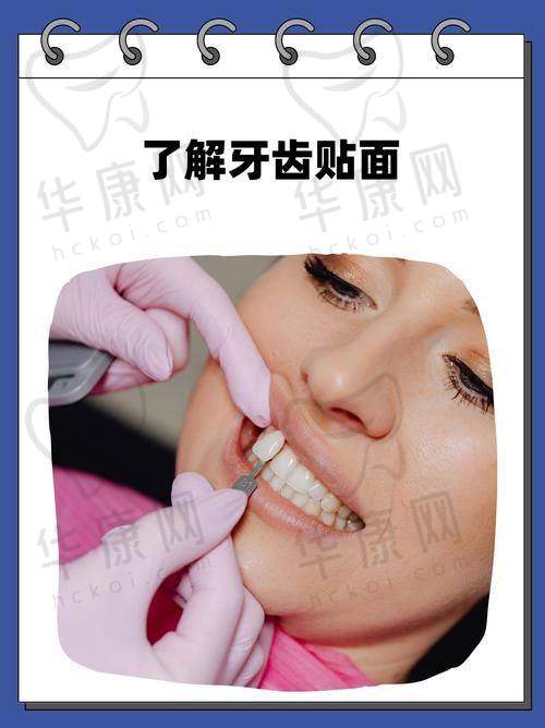 北海柏乐口腔全瓷牙贴面的成功实例