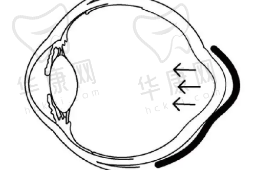 武汉华美整形外科医院正规吗？