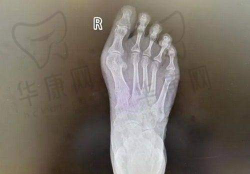 其他排名靠前的深圳吸脂医院特色